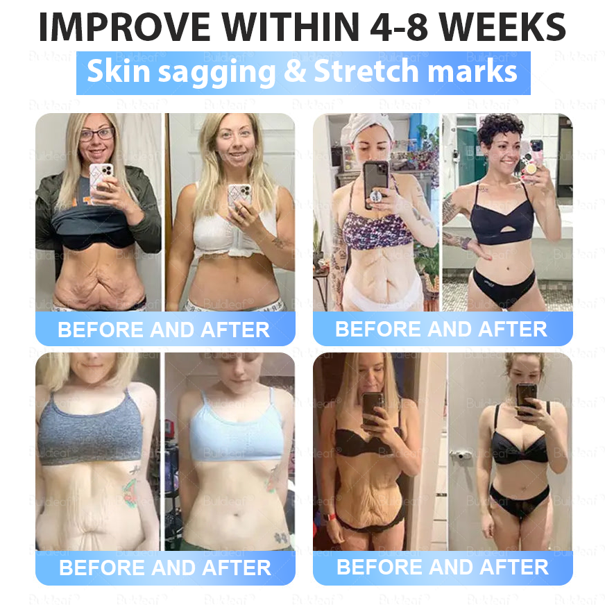 ๐๐ฎ๐ข๐ฅ๐๐๐๐๐ยฎOnly 5 boxes left! We're offering you an additional 30% discount! Get yourself in shape and healthy. Miss out now, and you won't have another chance until next year.