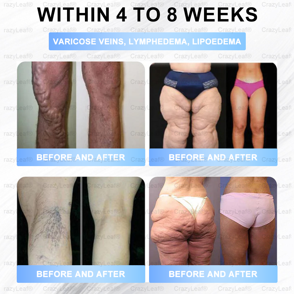๐๐ฎ๐ข๐ฅ๐๐๐๐๐ยฎOnly 5 boxes left! We're offering you an additional 30% discount! Get yourself in shape and healthy. Miss out now, and you won't have another chance until next year.