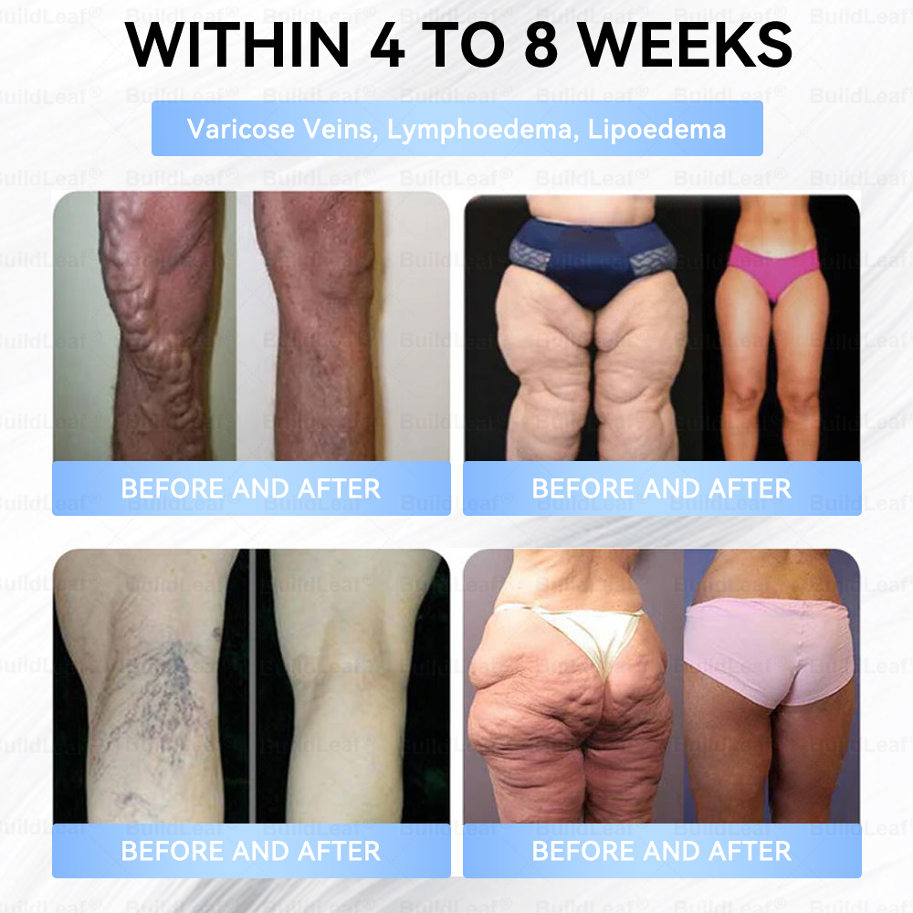 โ
๐๐ฎ๐ข๐ฅ๐๐๐๐๐ยฎOnly 5 boxes left! We're offering you an additional 30% discount! Get yourself in shape and healthy. Miss out now, and you won't have another chance until next year.