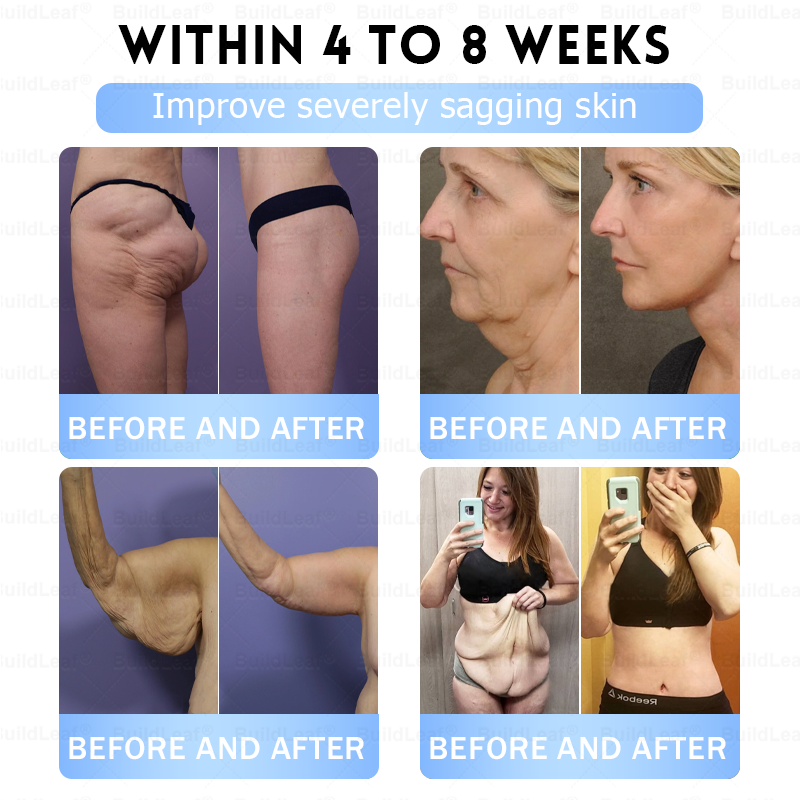 โ
๐๐ฎ๐ข๐ฅ๐๐๐๐๐ยฎOnly 5 boxes left! We're offering you an additional 30% discount! Get yourself in shape and healthy. Miss out now, and you won't have another chance until next year.
