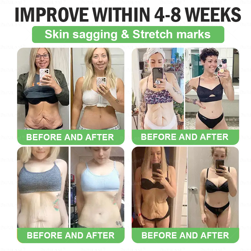 𝑩𝒖𝒊𝒍𝒅𝑳𝒆𝒂𝒇®|  Only 5 boxes left! We're offering you an additional 30% discount! Get yourself in shape and healthy. Miss out now, and you won't have another chance until next year.
