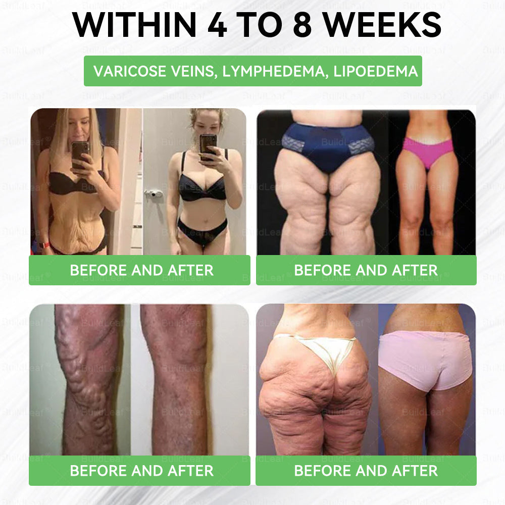 𝑩𝒖𝒊𝒍𝒅𝑳𝒆𝒂𝒇®|  Only 5 boxes left! We're offering you an additional 30% discount! Get yourself in shape and healthy. Miss out now, and you won't have another chance until next year.