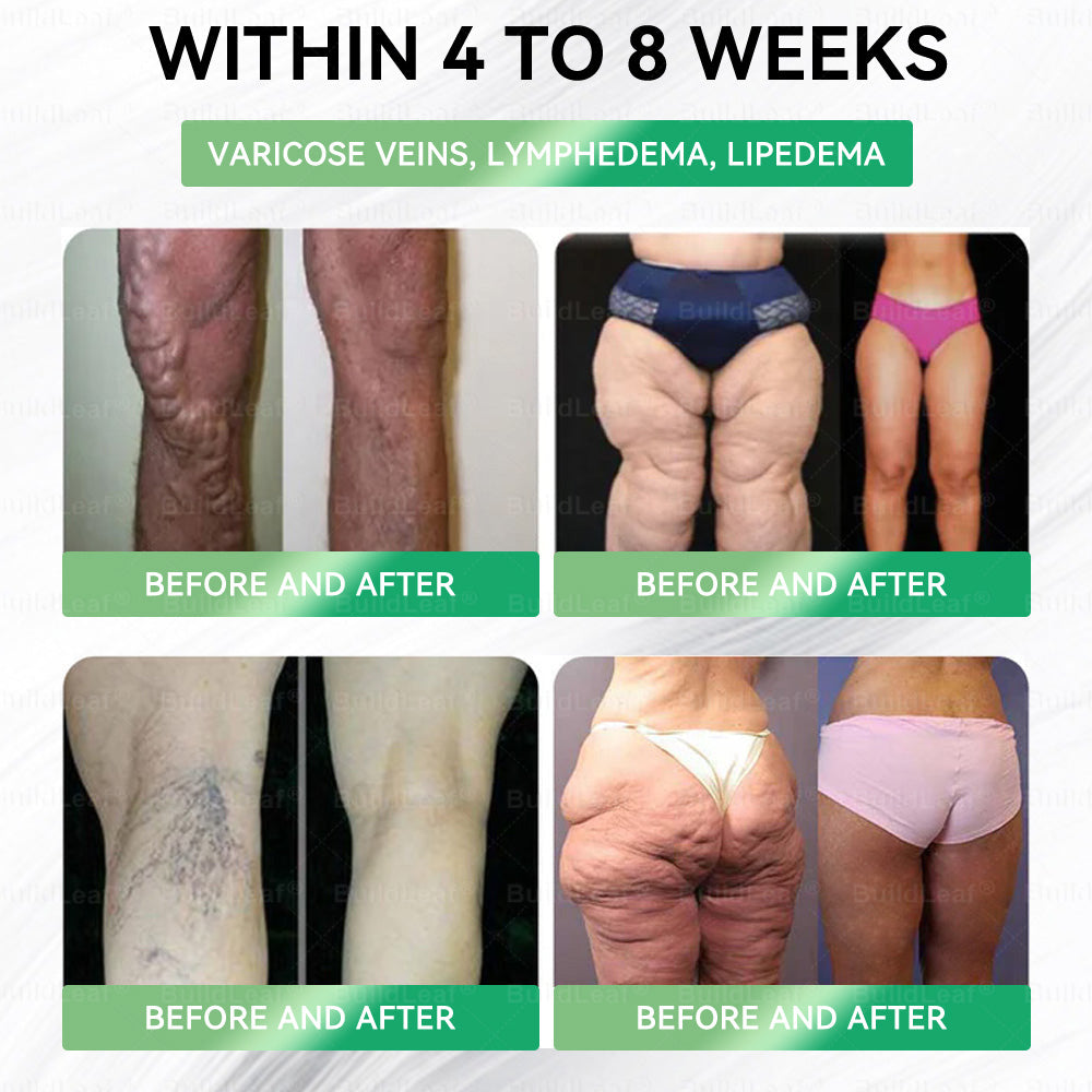 👨🏻‍⚕️𝑩𝒖𝐢𝒍𝒅𝑳𝒆𝐚𝒇®Only 5 boxes left! We're offering you an additional 30% discount! Get yourself in shape and healthy. Miss out now, and you won't have another chance until next year.