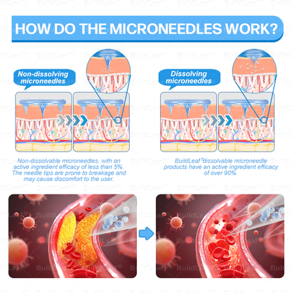 ✔️FDA Store |𝐵uil𝗱𝐿ea𝐟® 𝑮𝐋𝑃-1 Slim & Firm 𝑁ano 𝑀icroneedle 𝑃atch with Collagen,Turmeric&Matrixyl 3000 丨Obesity,Cardiovascular Diseas, Diabetes, Sleep Apnea, Joint Problems and More (Copy)