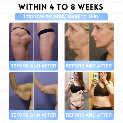 ✅𝐁𝐮𝐢𝐥𝐝𝐋𝐞𝐚𝐟®Only 5 boxes left! We're offering you an additional 30% discount! Get yourself in shape and healthy. Miss out now, and you won't have another chance until next year.